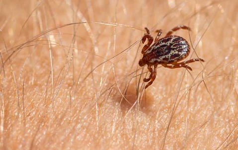 tick on a persons arm hair